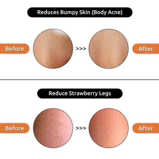 smooth & glowing complexion