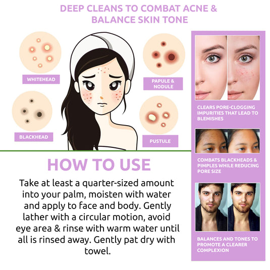 anti acne