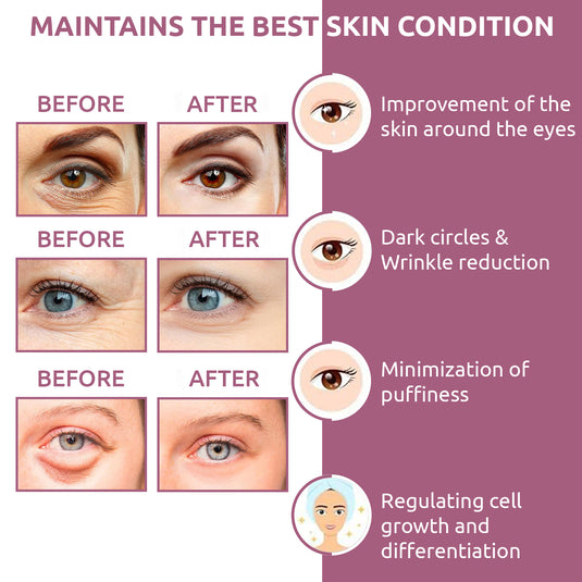 OG BEAUTY Ayurveda Dark Circles Under Eye Cream 50 GM