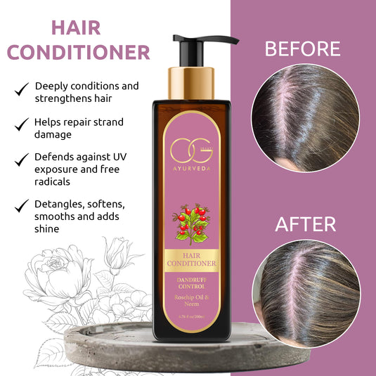 OG BEAUTY Ayurveda Dandruff Control Hair Conditioner 200 ML