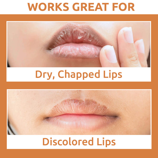 OG BEAUTY Ayurveda Dark Lips Lightening Vitamin C Lip Cream 50 GM